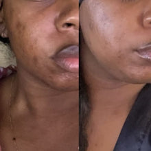 Load image into Gallery viewer, Amber Radiance (Hypigmentation Soap)